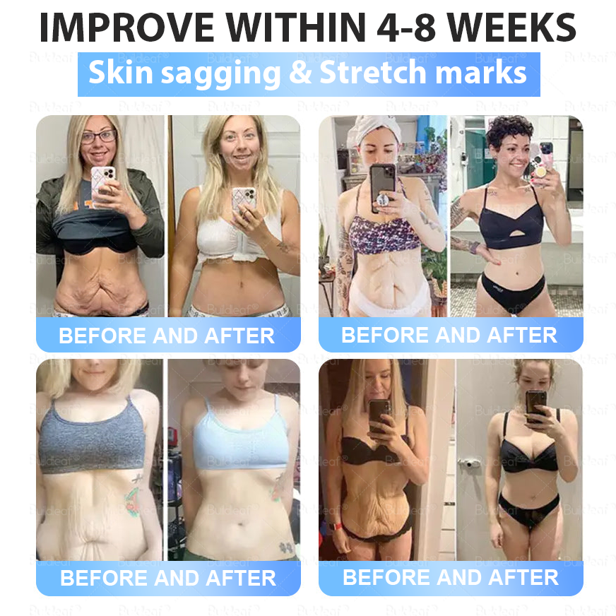 Only 10 Boxes left! We're offering you an additional 30% discount! Get yourself in shape and healthy. Miss out now, and you won't have another chance until next year.BuildLeaf®