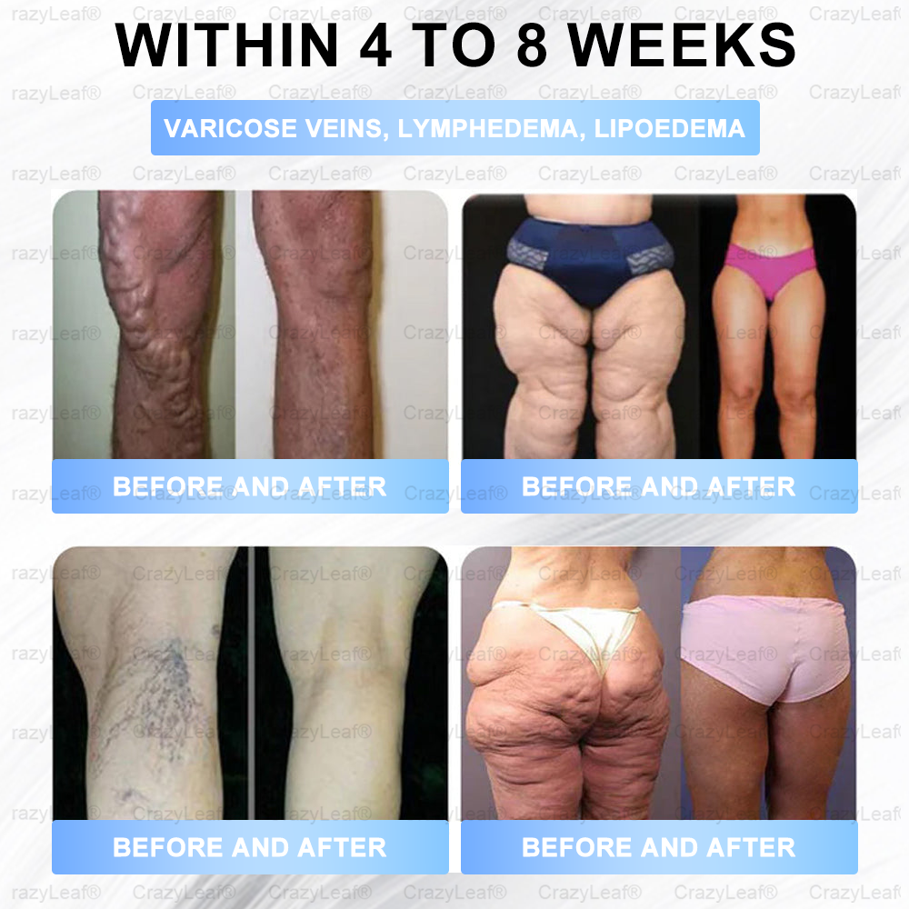Only 10 Boxes left! We're offering you an additional 30% discount! Get yourself in shape and healthy. Miss out now, and you won't have another chance until next year.BuildLeaf®