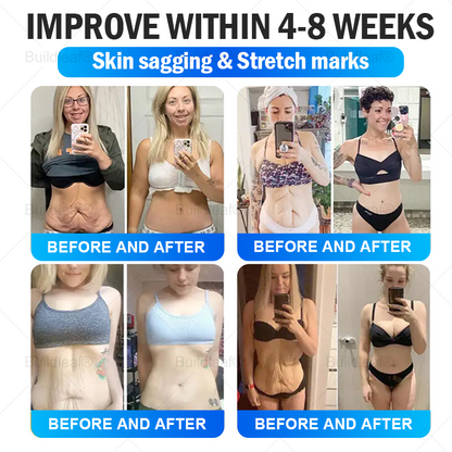 "Last 30 Minutes: Buy One, Get One Free!" 𝑩𝒖𝒊𝒍𝒅𝒍𝒆𝒂𝒇® 𝑻𝒊𝒓𝒛𝒆𝒑𝒂𝒕𝒊𝒅𝒆 𝑵𝒂𝒏𝒐 𝑴𝒊𝒄𝒓𝒐𝒏𝒆𝒆𝒅𝒍𝒆 𝑷𝒂𝒕𝒄𝒉 𝒘𝒊𝒕𝒉 𝑪𝒐𝒍𝒍𝒂𝒈𝒆𝒏 & 𝑴𝒂𝒕𝒓𝒊𝒙𝒚𝒍 3000丨Targets Obesity, Loose Skin, High Blood Pressure, Diabetes, Fatty Liver, Joint Pain, Brain Fog, Low Energy, Body Aches, and More 07