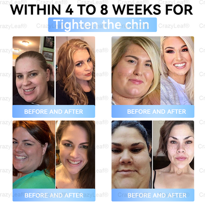 Only 10 Boxes left! We're offering you an additional 30% discount! Get yourself in shape and healthy. Miss out now, and you won't have another chance until next year.BuildLeaf®