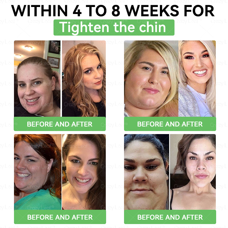 Only 10 Boxes left! We're offering you an additional 30% discount! Get yourself in shape and healthy. Miss out now, and you won't have another chance until next year.CrazyLeaf®